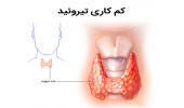 پروانه ای اثرگذار در افزایش سوخت و ساز بدن